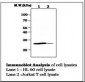 BCL2 / Bcl-2 Antibody (clone 11C5)